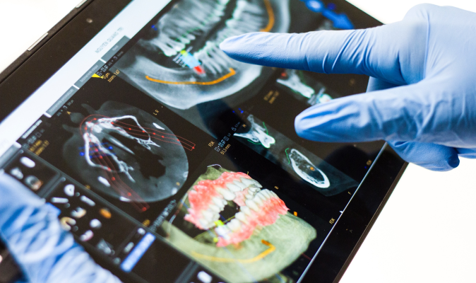 성문치과병원만의 차별점